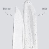 Peeling