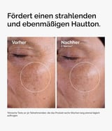 The Ordinary Direct Acids Glycolic Acid 7% Exfoliating Toner