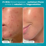 2% BHA Liquid Exfoliant